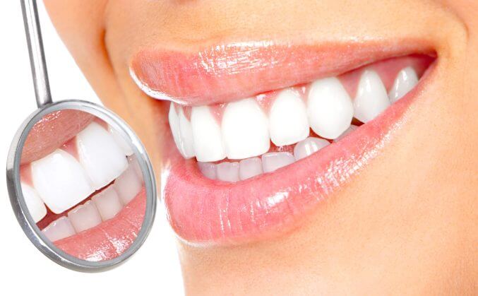 Implantes dentales en Mirasierra